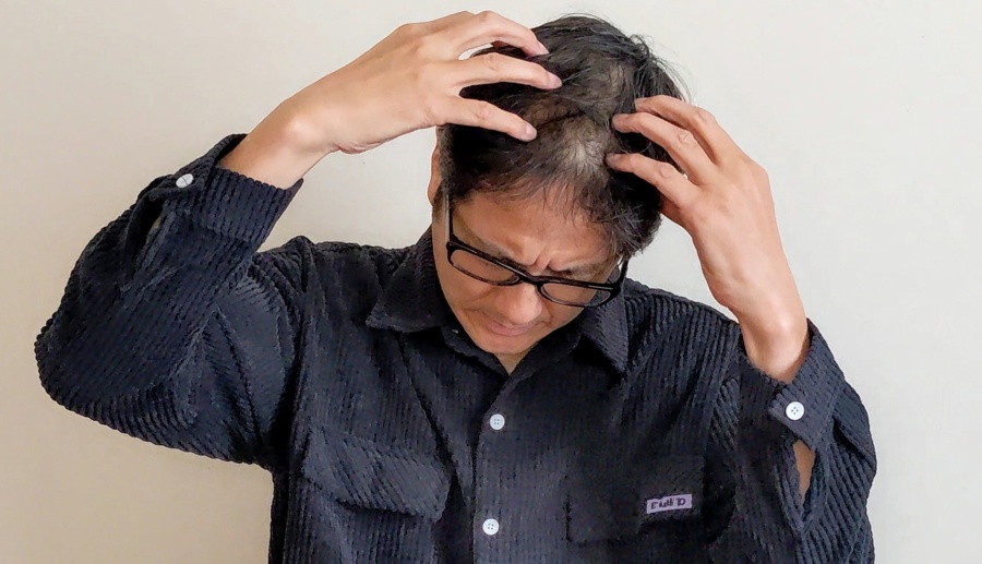 白髪は元に戻るのでしょうか？